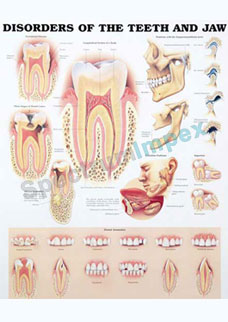 Disorders Of The Teeth And Jaw 