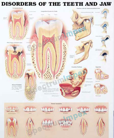 Disorders Of The Teeth And Jaw
