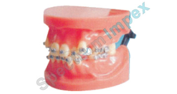 Fixed Orthodontic Model (Dislocation)